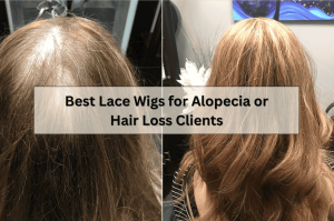 Best Lace Wigs for Alopecia or Hair Loss Clients